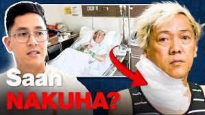 MY GORETEX SEPTORHINOPLASTY JOURNEY BY DR ALFRED DIZON OF PAMPANGA