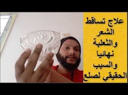 علاج تساقط الشعر والثعلبة من الجذور نهائيا وشرح اسباب وعلاج الصلع Youtube Thumbs Up Playbill