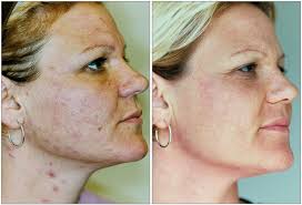 Tawny — VILLANI MEDICAL