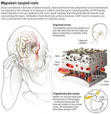 fda just approved the first drug to prevent migraines