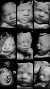 Image result for tbn:T5UajvfpShvp6M::www.photoslinks.com/index.php%3Foption%3Dcom_joomgallery%26func%3Dwatermark%26catid%3D4%26id%3D23%26Itemid%3D2