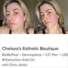 Reviews of Chelsea's Esthetic Boutique