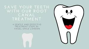 They may be able to fix the issue at hand. Saving Your Teeth With Root Canal Treatment 4 Gentle Steps Angel Smile