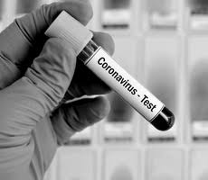 Antibody testing analyzes your blood to determine if. Update Blue Shield Of California Waiving Cost Sharing And Prior Approval For Coronavirus Testing Blue Shield Of California News Center