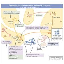 Image result for Precocious Puberty