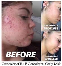 Rodan+Fields