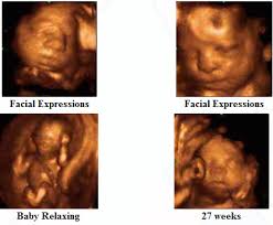 Maybe you would like to learn more about one of these? 4d Ultrasound Scan Fetal Video Clips Dr N Layyous Ultrasound 4d Ultrasound Baby Ultrasound