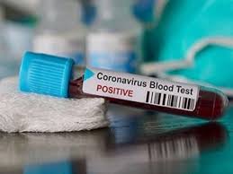 Delhi S Rohini Jail Inmate Tests Positive For Covid 19 English Lokmat Com
