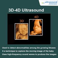 Ultrasound Clinic In Noida 4d Ultrasound Ultrasound Ultrasound Technology