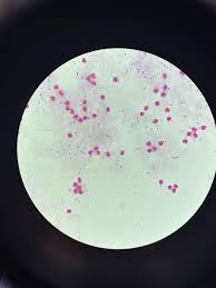 Image result for CSF Gram Stain