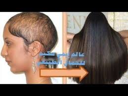 ضعيه علي جذور الشعر اثناء النوم وسيصل شعرك للركب اطالة وتكثيف الشعر بدون خلطات Youtube Extreme Hair Growth Extreme Hair Fall Hair