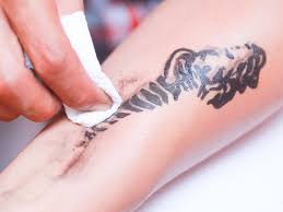Honey is effective natural way to remove tattoo at home, especially for light colored and tiny tattoos. How To Remove A Tattoo At Home Learn How To
