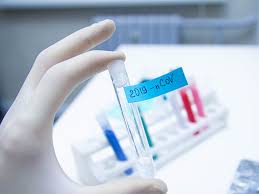 Get your results through our new patient portal. Hong Kong Researchers Create Fastest Coronavirus Diagnostic Test To Date 2020 02 07 Bioworld