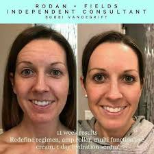 Repair and regenerate your skin with our GF 15% solution. This formula  makes use of 3 plant-derived technologies (IGF, EGF, TGF) that are similar  to our skin's natural growth factors, which begin