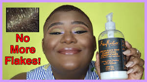 My boyfriend has black flakes in his hair and his scalp is itchy in the back of his head and he keeps scratching. Get Rid Of That Crusty Scalp Girl Seborrheic Dermatitis Dandruff And Dry Scalp On 4c Hair Youtube
