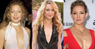 She rose to prominence for her performance in the film almost fa. Kate Hudson Plastic Surgery Before And After Pictures 2021