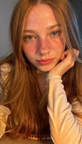 Most people make jokes about my skin. You too?