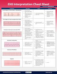 Ekg Interpretation Cheat Sheet Free Download Ekg Interpretation Cheat Sheets Ekg Interpretation Nursing Ekg Cheat Sheets