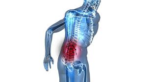 Back Pain Linked To Knee Pain Youtube