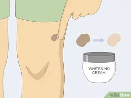 Sometimes, they are very cute, they give character, and make honey, on the other hand, is completely natural and harmless. 3 Ways To Remove Moles Quickly Wikihow