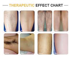 Don't buy a laser hair remover before reading these reviews. Laser Hair Removal New U Professional Natural Beauty Treatments In Las Vegas