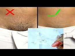 Sit in a hot bath for a few minutes or hop in the shower. Don T Shave Again Remove Unwanted Private Part Hair Instantly And Pemenetly Youtube Best Hair Removal Products Natural Hair Removal Hair Removal Permanent