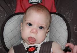 What is Beckwith-Wiedemann syndrome?