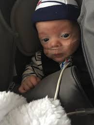 My sweet Atticus was born sept.23 he was only 5 pounds 13.8 oz and 18  inches long, the only complications he has was him needing oxygen but he's  only