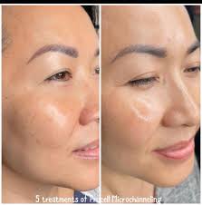 Beach Cottage Day Spa (@beachcottagedayspasb) • Instagram photos and videos