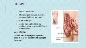 Tanda tanda hiv #3 ruam dan luka di kulit. Asuhan Keperawatan Appendiksitis Ppt Download