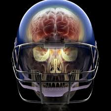 Heading footballs may cause brain injuries: Super Bowl 2020 Football Concussions The Link Between Head Injuries And Cte Explained Vox