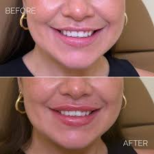 Lauren Elaina Walker