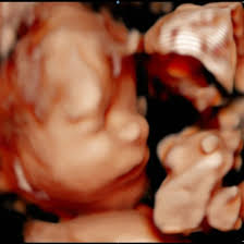 Talking Toby (@talking_toby) • Instagram photos and videos