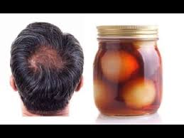 Este Champu Hara Que Tu Cabello Crezca Como Loco Quedara Brilloso Y Con Volumen Youtube Caida Del Cabello Caspa Calvicie