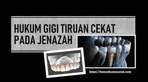 Gigi palsu secara garis besar terbagi jadi 2, yang permanen dan lepasan. Hukum Gigi Tiruan Cekat Pada Jenazah Youtube