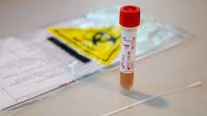 Learn vocabulary, terms and more with flashcards, games and other study tools. Where Can You Get Tested For Covid 19 In Malaysia Malaysia Malay Mail