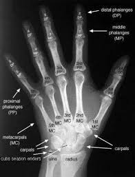 Pin By Ruth Brown On Medical Radiology Student Medical Anatomy Medical Knowledge