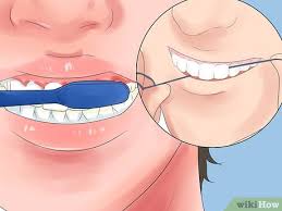 3 why do braces hurt? 5 Ways To Alleviate Orthodontic Brace Pain Wikihow