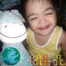 Good day mag ask lang sana if mukha po ba syang may down syndrome ? . If  ever saan po may malapit sa taguig na may 2d echo & karyotyping . Public