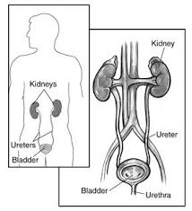 Medullary Sponge Kidney National Kidney And Urologic Diseases Information Clearinghouse Medullary Sponge Kidney Kidney Stones Kidney