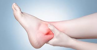 It can lead to top of the foot numbness, burning and tingling. Big Toe Arthritis Hallux Rigidus Footcaremd