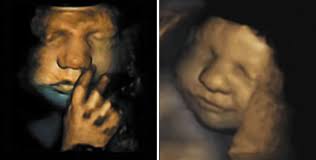 Sorry, hab zwar schon nen 6jährigen, aber ist schon sooo lange her, daß ich mich nicht mehr dran erinnern kann, wie das damals war. Baby Lachen Und Weinen Im Mutterleib