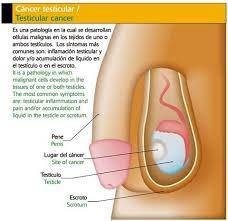 pin en cancer y tumores