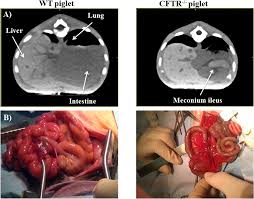 For the collaboration that has cystic fibrosis canada extends its appreciation to dr. Computed Tomography Ct Scanning Facilitates Early Identification Of Neonatal Cystic Fibrosis Piglets