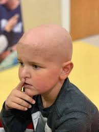 As pastor Jerry Eze decreed, low platelet, the devil is a liar, let it be  reversed in the name of Jesus..