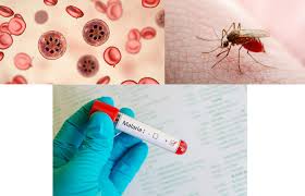 Image result for Malaria