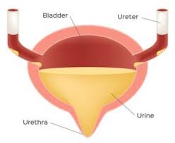 Image result for Stress Incontinence