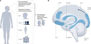 Image result for Body Dysmorphic Disorder