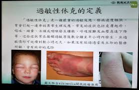 洪杰民 報導 / 南投縣 生病還是找專業醫師，別亂服藥也別亂打針。南投竹山一名男子，因為過敏，就跑到附近藥房打針. éŽæ•ä¹Ÿæœƒå¼•ç™¼ä¼'å…‹ é†«å¸« çš®è†šç™¢å°±è¦æ³¨æ„ Hehoå¥åº·
