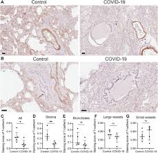 Frontiers | New evidence for T-cadherin in COVID-19 pathogenesis,  endothelial dysfunction, and lung fibrosis